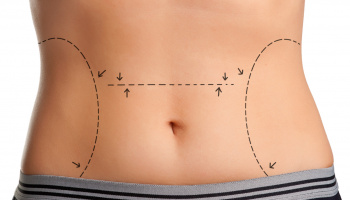 Appendix Surgeon in Nashik Appendix Surgeon in Nashik