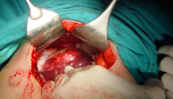 Appendix Surgeon in Nashik Appendix Surgeon in Nashik