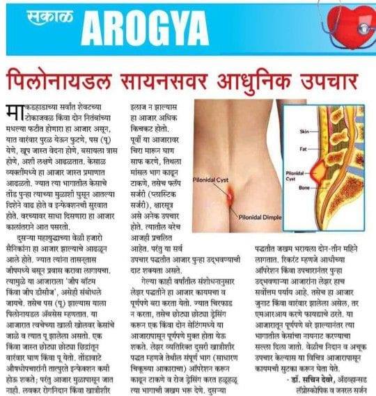 Pilonidal Sinus(Nasur) Treatment in Nashik| Saru Hospital | Dr Sachin Deore