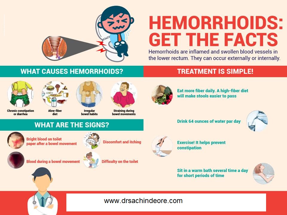 Laser Treatment for Piles | Saru Hospital | Dr Sachin Deore