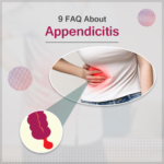 9 FAQ about Appendicitis