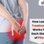 Laser Treatment for Piles in Nashik