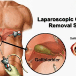 GallBladder Surgeon in Nashik