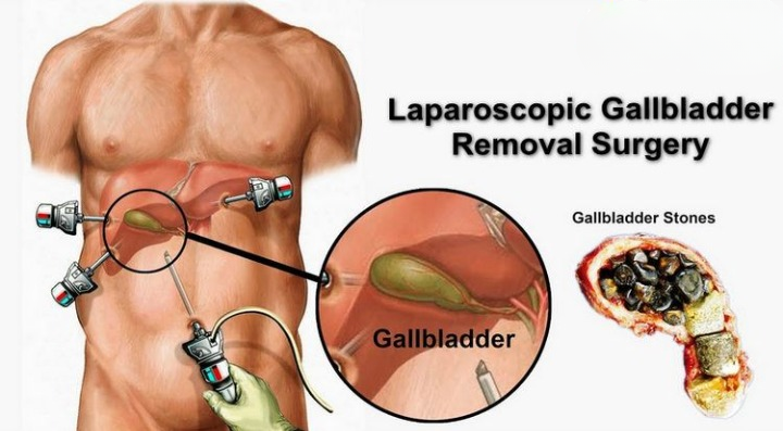 GallBladder Surgeon in Nashik